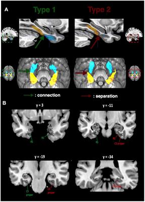 Three-Dimensional Probabilistic Maps of Mesial Temporal Lobe Structures in Children and Adolescents’ Brains